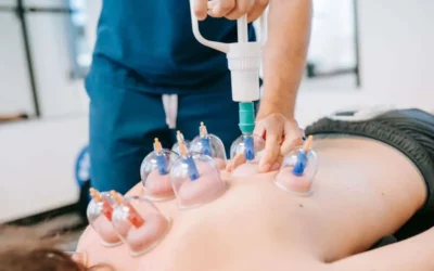 Unlocking the Power of Cupping Therapy: Enhancing Recovery and Wellness