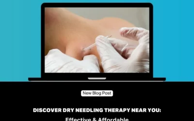 Discover Dry Needling Therapy Near You: Effective & Affordable