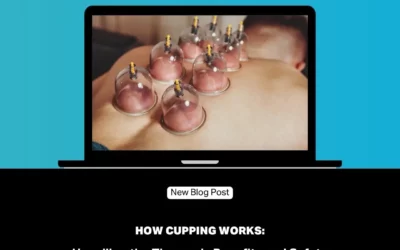 How Cupping Works: Unveiling the Therapy’s Benefits and Safety